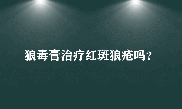 狼毒膏治疗红斑狼疮吗？