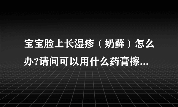 宝宝脸上长湿疹（奶藓）怎么办?请问可以用什么药膏擦那？不过宝宝才只有一个多月