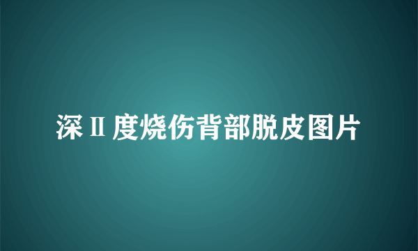 深Ⅱ度烧伤背部脱皮图片