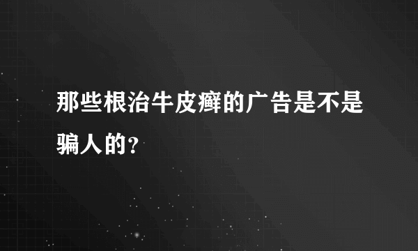 那些根治牛皮癣的广告是不是骗人的？