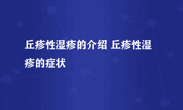 丘疹性湿疹的介绍 丘疹性湿疹的症状