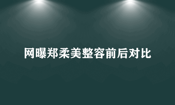 网曝郑柔美整容前后对比